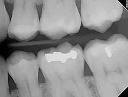digital xray
