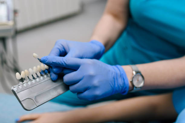 A dentist holding a color shade guide, helping a patient choose the perfect veneer match for their teeth.