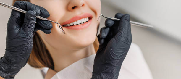 A happy patient smiling with perfectly aligned, bright white teeth after getting veneers.
